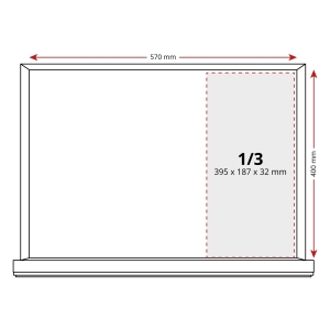 Комплект за настройка на двигателя Renault, Opel, Mercedes, Nissan – M9R, M9T, R9M, R9N, OM622, OM626, OM699